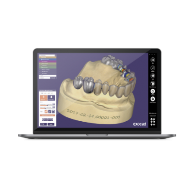 LES LOGICIELS 3D DENTAIRES CAD/CAM Logiciel EXOCAD Dental CAD 3D